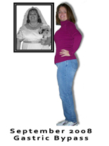 Monica. Surgery date: September 2008. Gastric Bypass.
