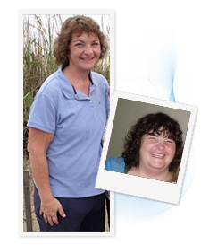 Shelly before and after
