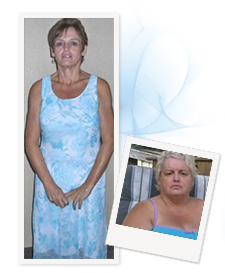 Cathy before and after