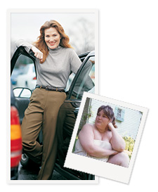 Dee before and after