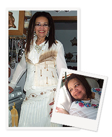 Francene before and after