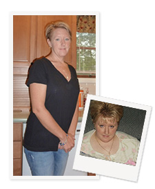 Jacqueline before and after