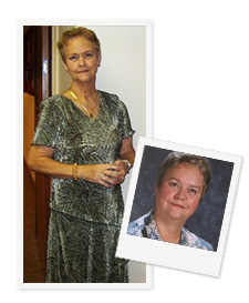 Lynda before and after