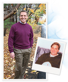 Tom before and after