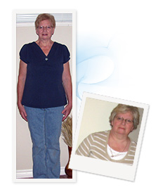 Wendy before and after