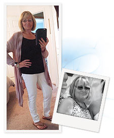 Edna before and after