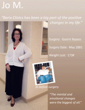 Does Gastric Bypass Work Long-Term?