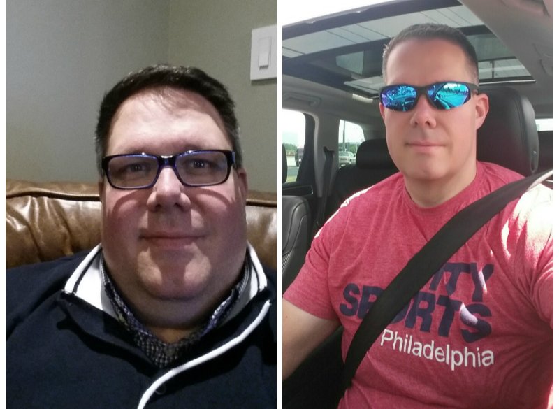 Shawn M. with a dramatic before-and-after photo, after successfully having gastric sleeve surgery at Barix Clinics