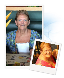 Janice F.'s Before and After Photo after having successful gastric sleeve surgery