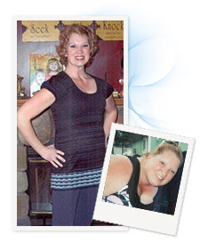 Gastric Bypass Surgery Success Story