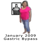 January 2009 Gastric Bypass
