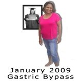 January 2009 Gastric Bypass