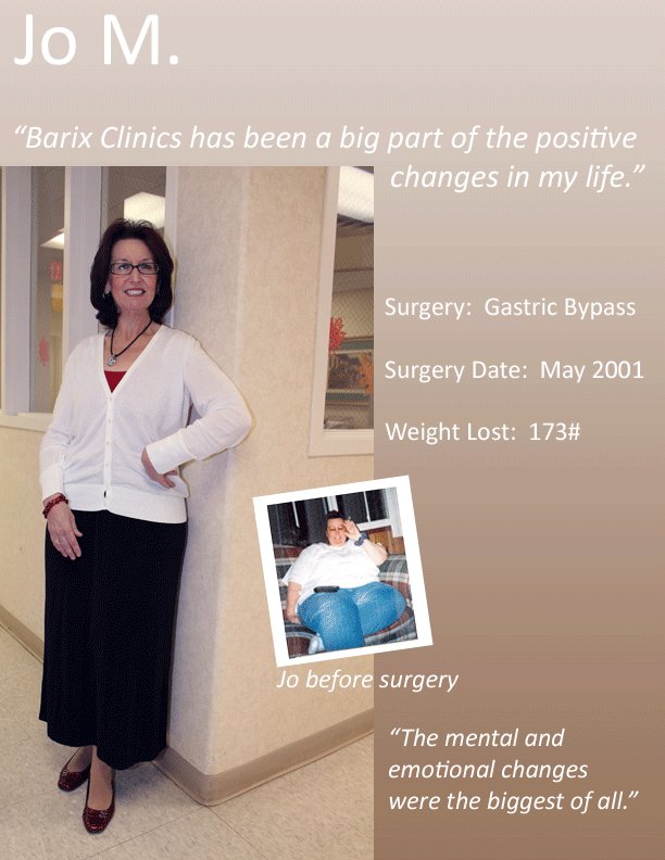 Does Gastric Bypass Work Long-Term?
